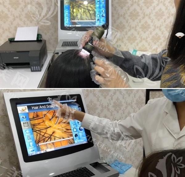 沈阳华美植发植发技术如何？医生操作熟练+毛囊提取精细+术后恢复案例多  